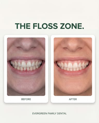 The Floss Zone